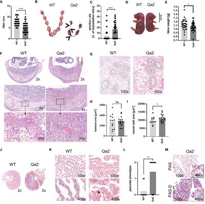 Human Leucocyte Antigen G and Murine Qa-2 Are Critical for Myeloid Derived Suppressor Cell Expansion and Activation and for Successful Pregnancy Outcome